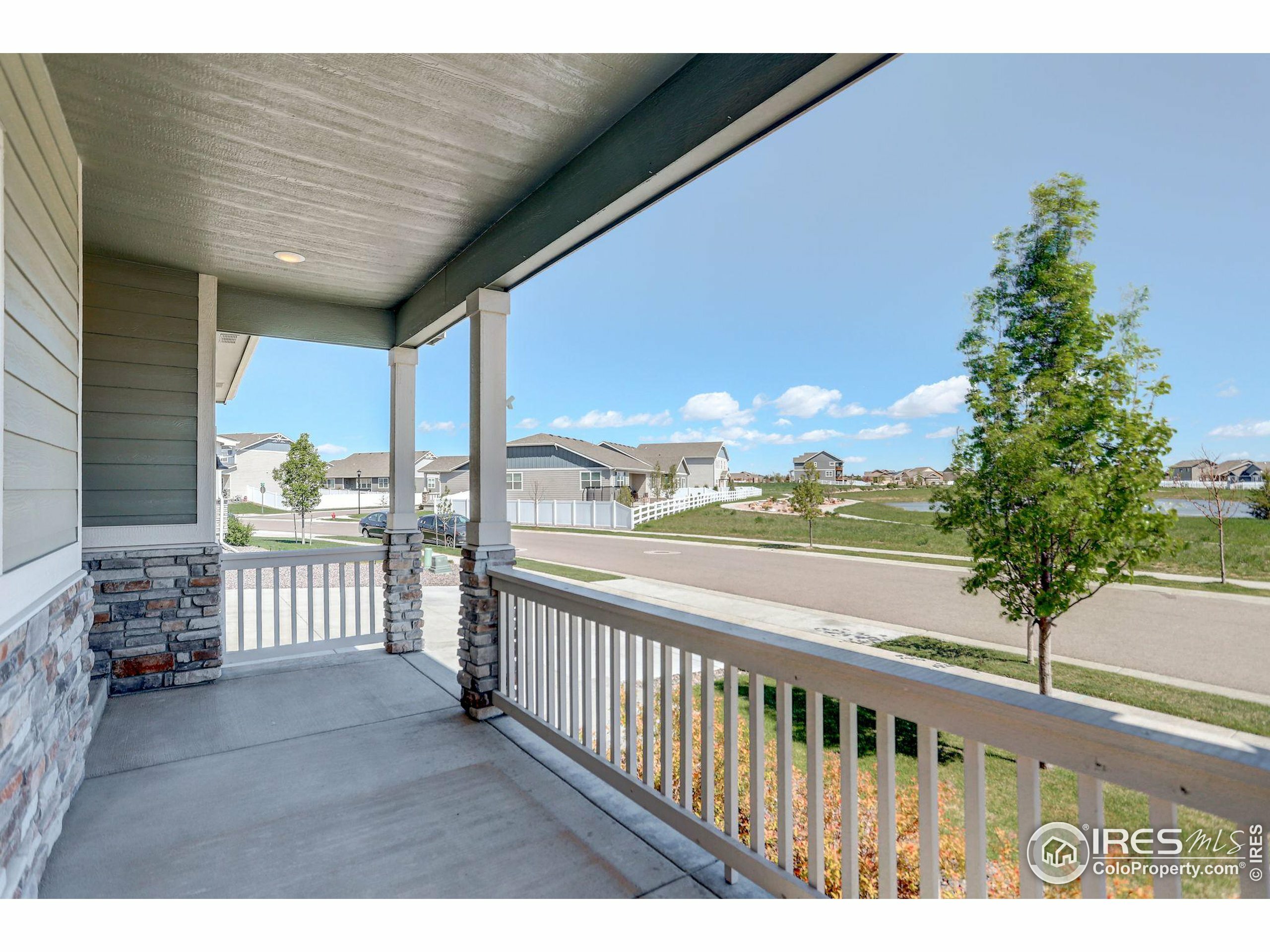 Property Photo:  1129 Ibex Dr  CO 80550 