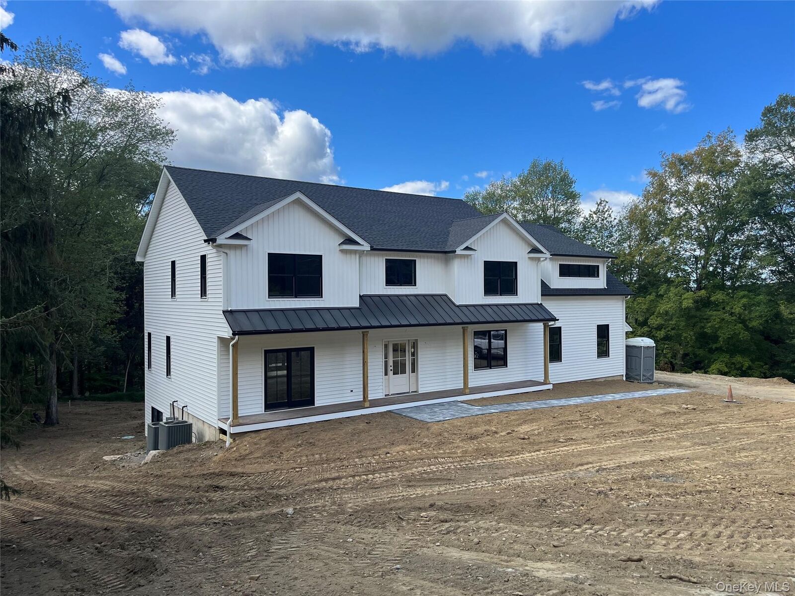 Property Photo: 27 Sun Hill Road NY 10536